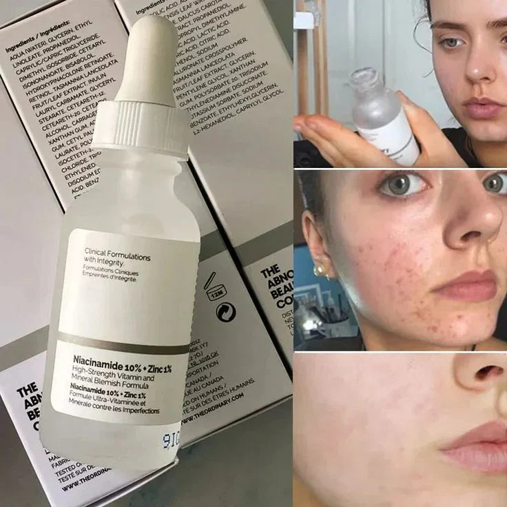 The Ordinary Niacinamide 10% + Zinc 1%